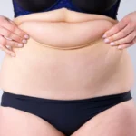 Restoring Breast Volume After Pregnancy, Weight Change, and Aging